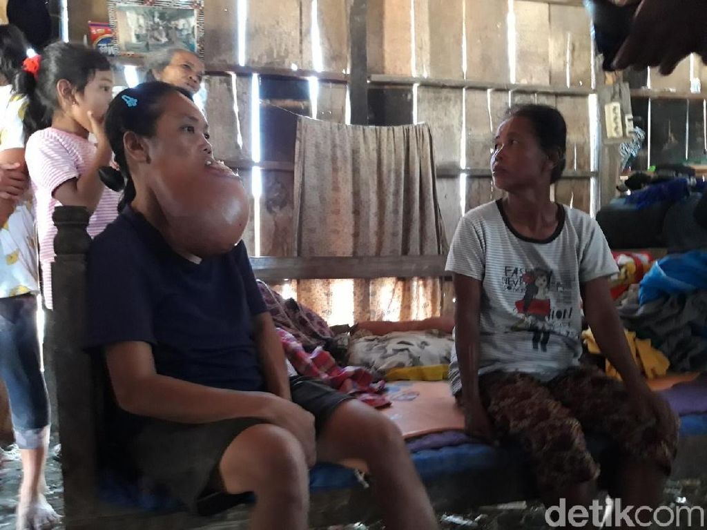 Menjenguk Sukinem yang 9 Tahun Menderita Kanker di Boyolali